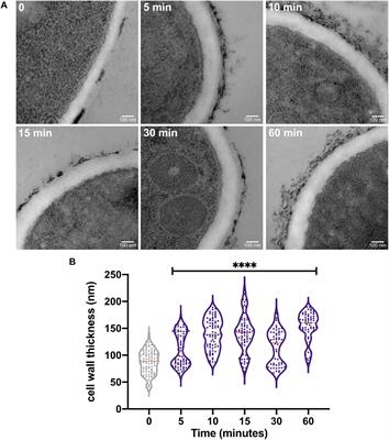 The Heat Shock Transcription Factor HsfA Is Essential for Thermotolerance and Regulates Cell Wall Integrity in Aspergillus fumigatus